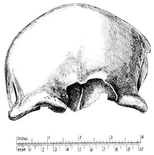 Drawing of a skull