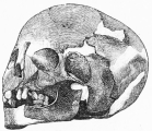 No. 153. Skull of a Woman, found near some gold ornaments
in the Lowest Stratum (13 M.).